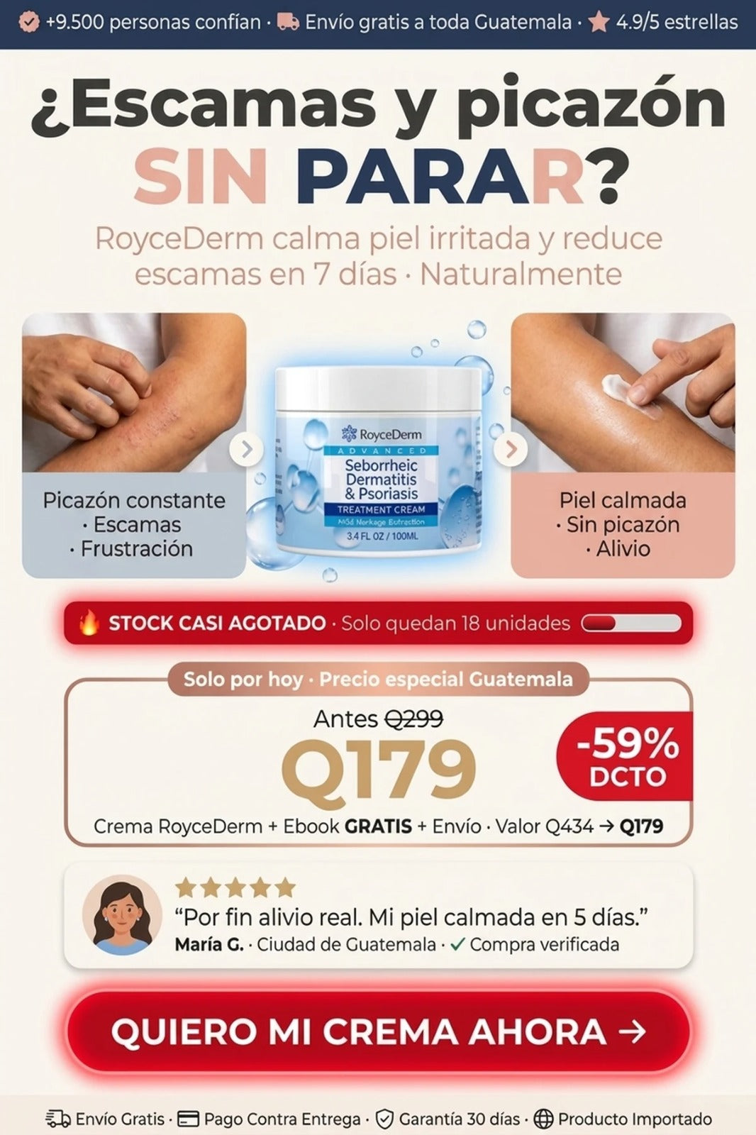 RoyceDerm - Ayuda a aliviar picazón y resequedad visible